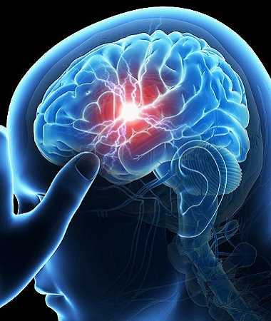 Neurological Disorders